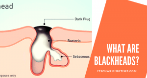 Graphical presentation of inside and outside blackheads