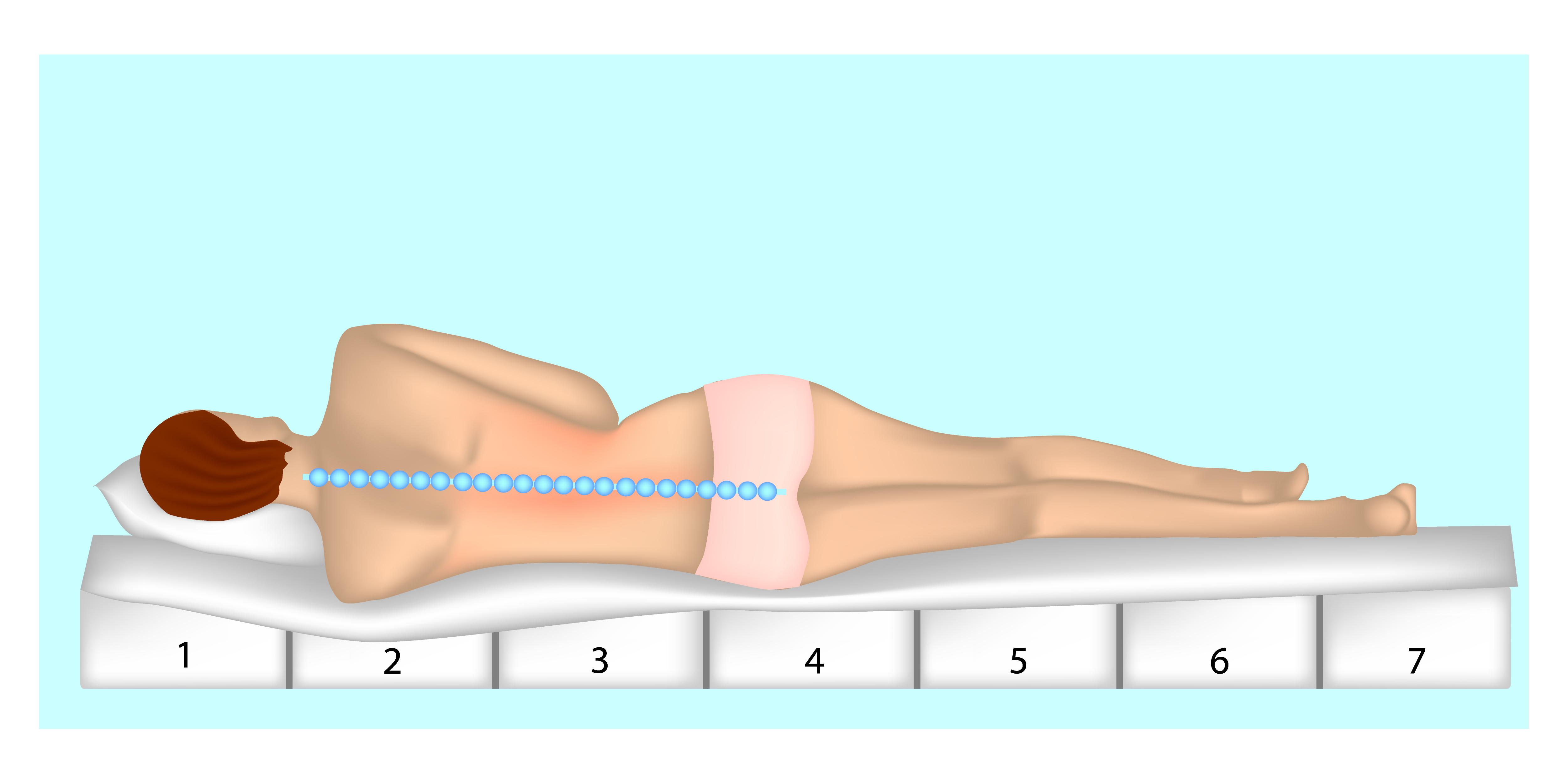 ортопедический матрас при компрессионном переломе позвоночника