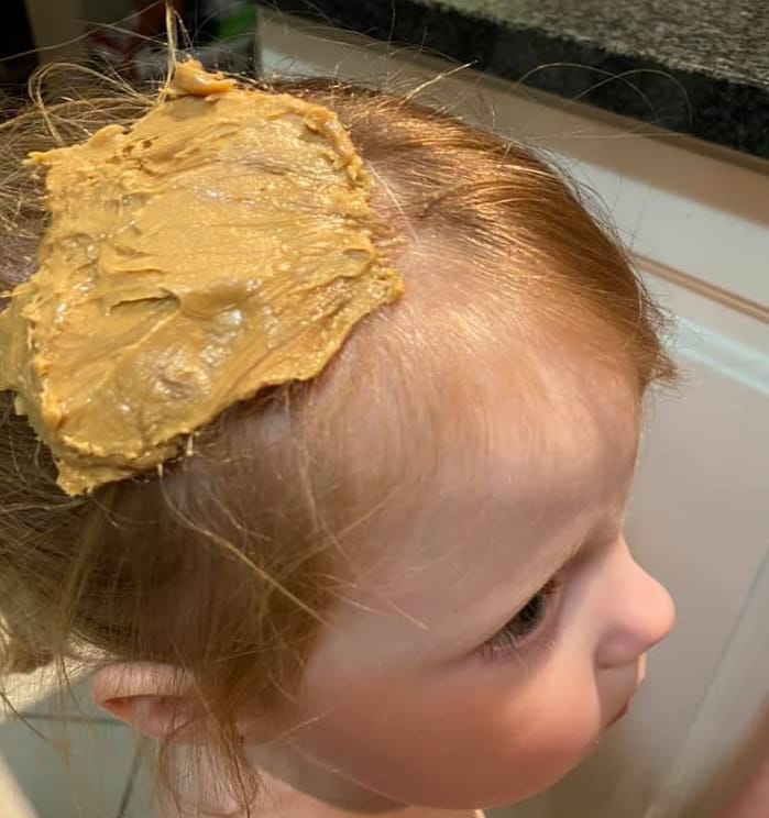 Peanut Butter applied on hair for gum removal