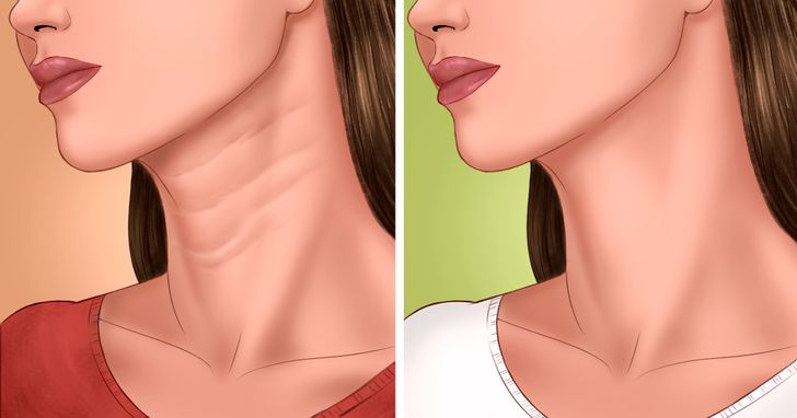 how-to-get-rid-of-horizontal-neck-lines-naturally-its-charming-time