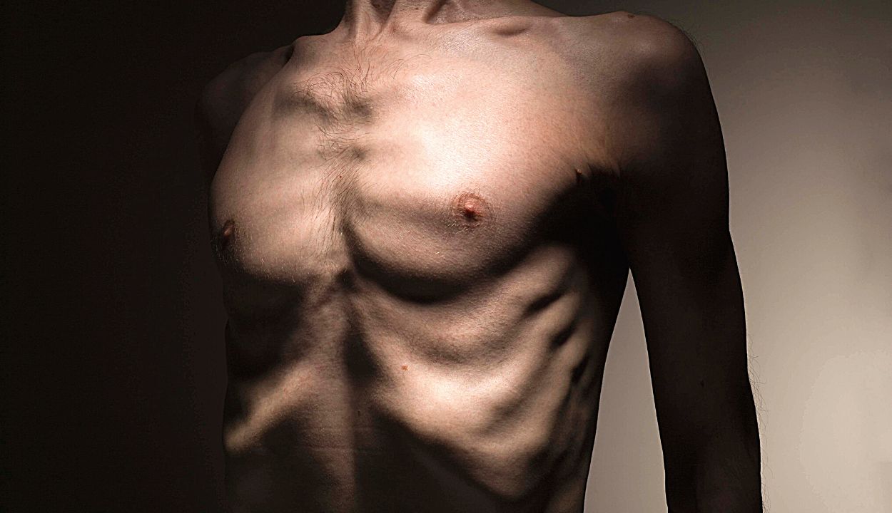 выпирающая грудь у мужчин фото 77