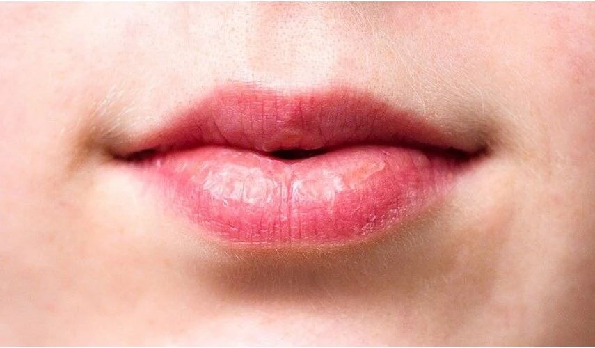 Lips show your Health Conditions
