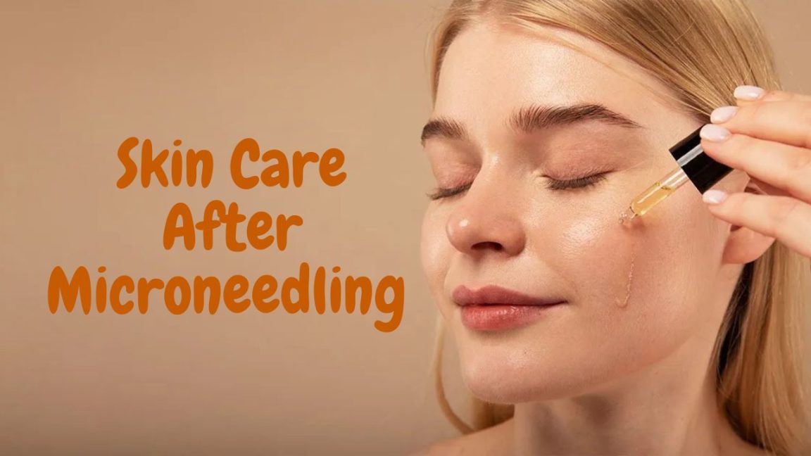 What to Put on the Skin After Microneedling? Its Charming Time