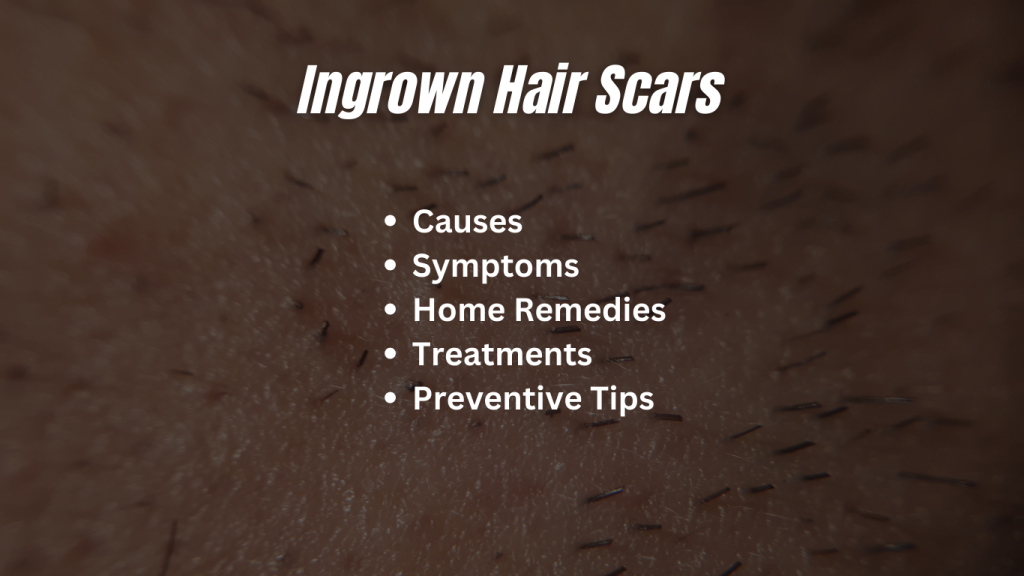 Ingrown Hair Scars Causes, How To Treat, & Prevention Tips Its