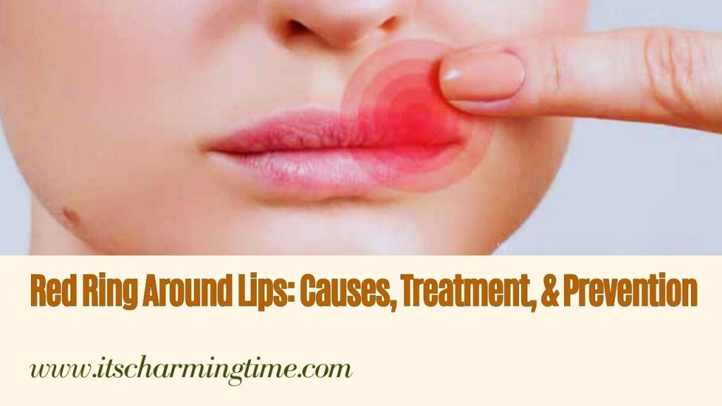 red-ring-around-lips-causes-treatment-prevention-its-charming-time