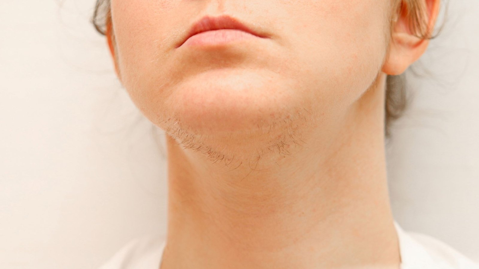 Common Places Where the Vellus Hairs Grow
