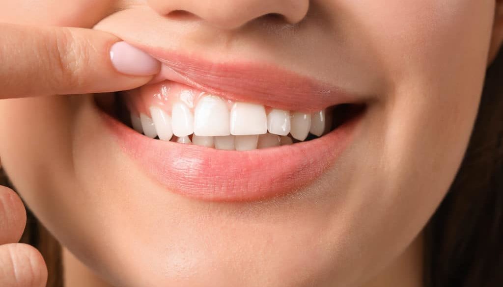 Natural Remedies for Gum Disease and Loose Teeth