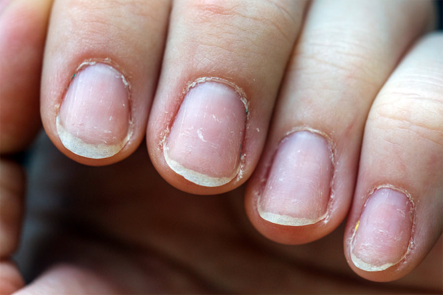 How to Condition Your Nails After the Gel Nail Polish is Removed