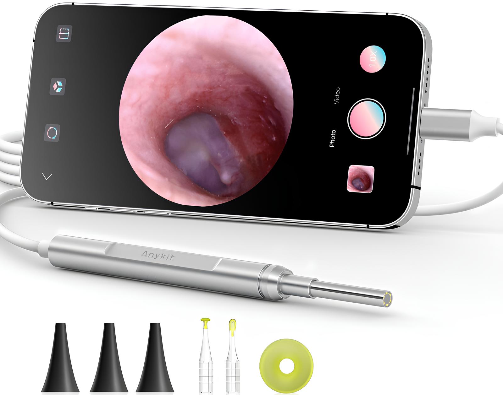 Smart Otoscope With Live Video