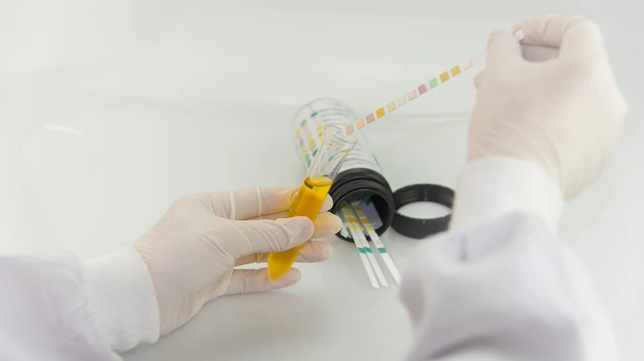 Creatinine Test Carried Out